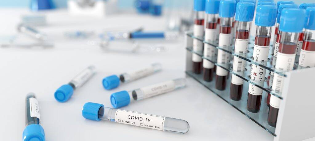 testing-for-coronavirus-covid-19-in-a-lab-covid-me-8K3AJFY-1024x461 testing-for-coronavirus-covid-19-in-a-lab-covid-me-8K3AJFY-1024x461