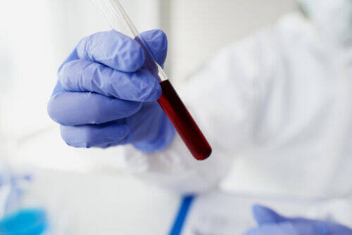 coronavirus covid-19 coronavirus covid-19