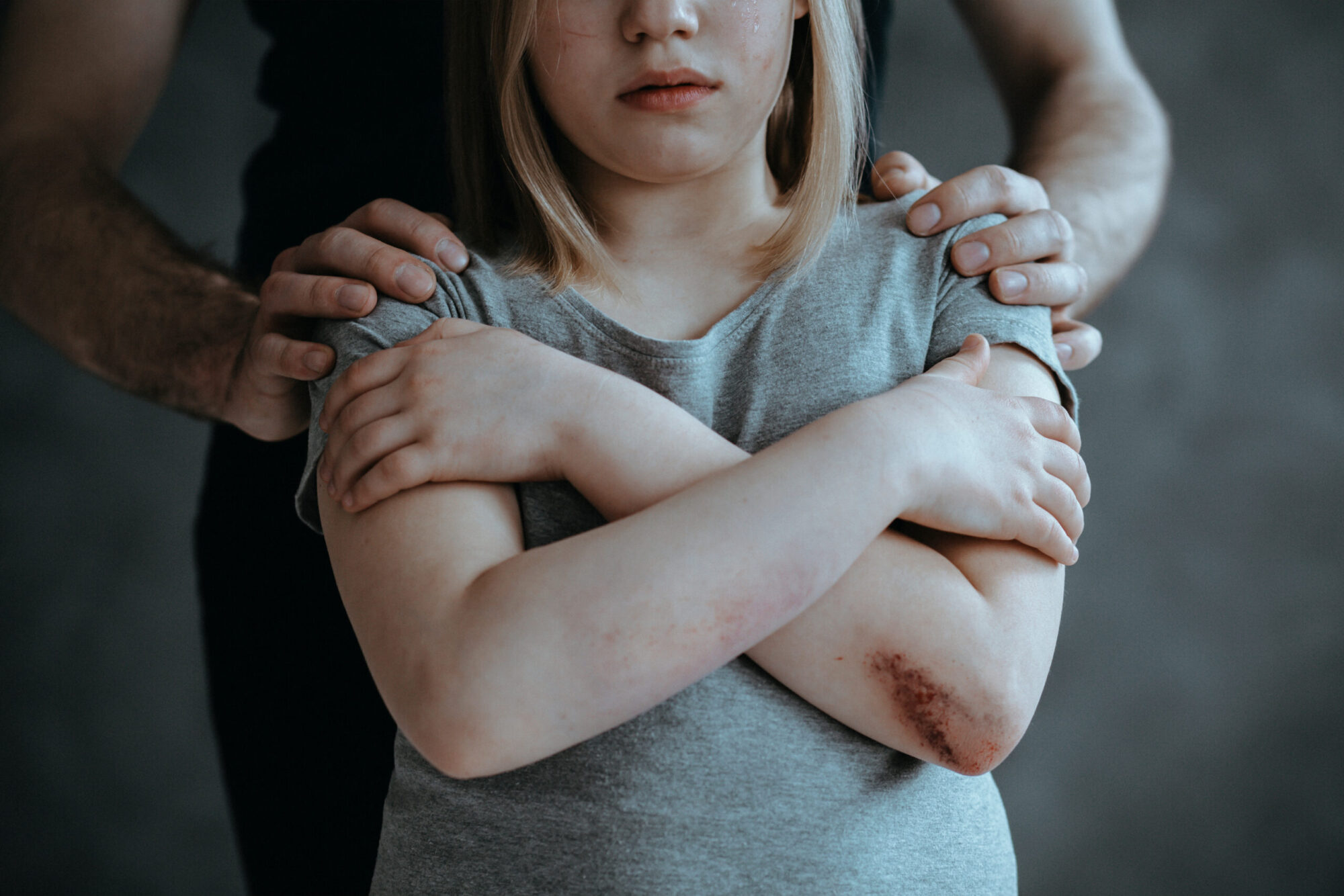 Une petite fille blessée près d'un coude est tenue par les épaules par un homme, alors qu'elle tient ses bras en croix.
