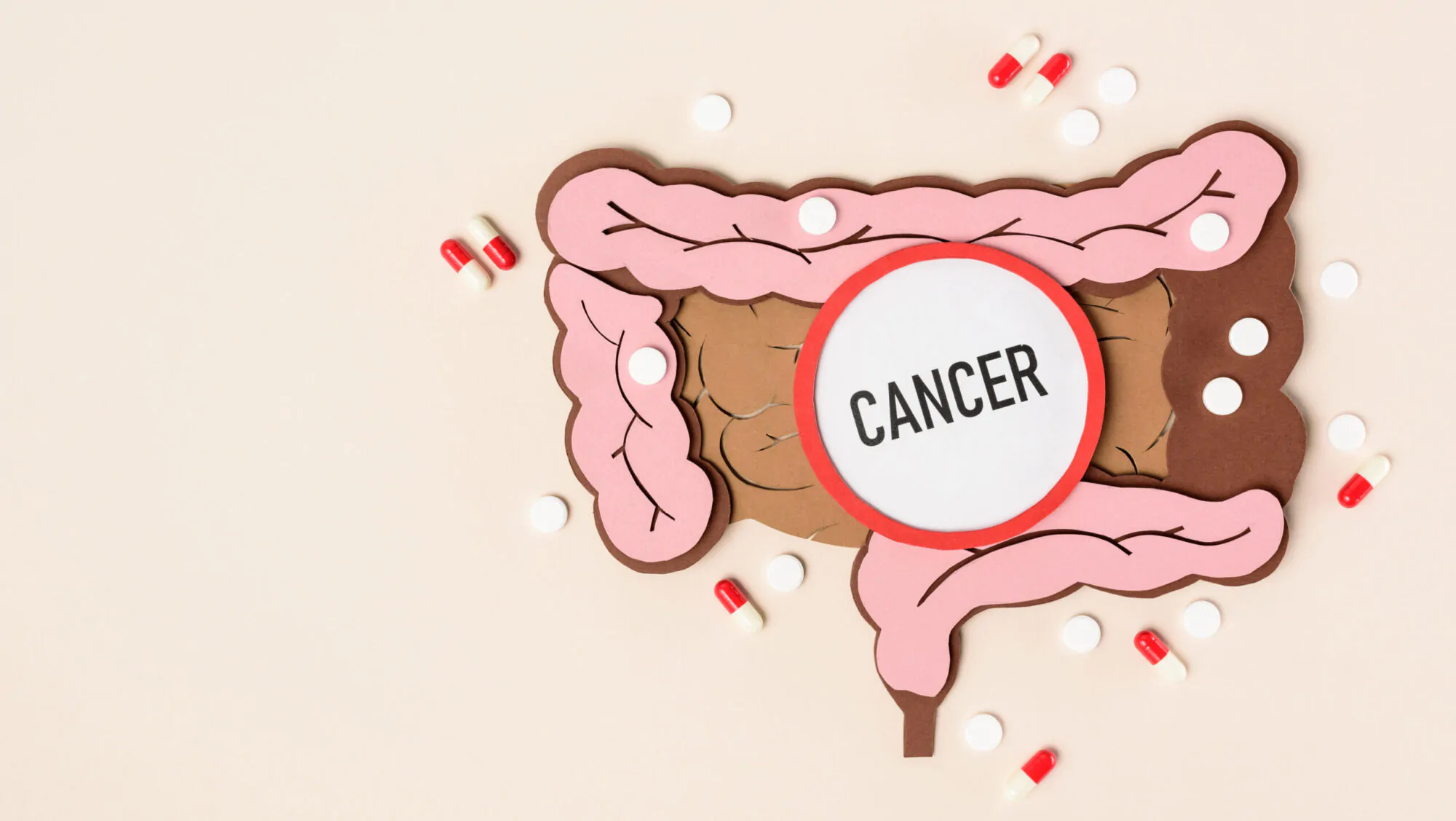 Cancer